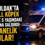 Zonguldak’ta pitbull köpek anne ve 5 yaşındaki çocuğuna saldırdı: Hastanelik oldular!