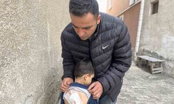 Sokak köpeklerinin saldırdığı 4 yaşındaki çocuk ölümden döndü