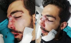 Kazada ağır yaralanan genç hastanede dakikalarca bekletildi: Tansiyon yükseldi