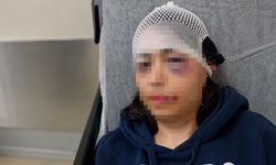 Ayrılık kararını kabullenemeyip kız arkadaşını darbeden sanık: 'Çok üzgünüm'