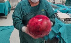 Doktorlar gözlerine inanamadı: 1,5 yıl ertelediği ameliyatta karnından dev kitle çıktı