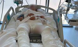Otomobilin çarptıktan sonra üzerinden geçtiği genç kız ağır yaralandı