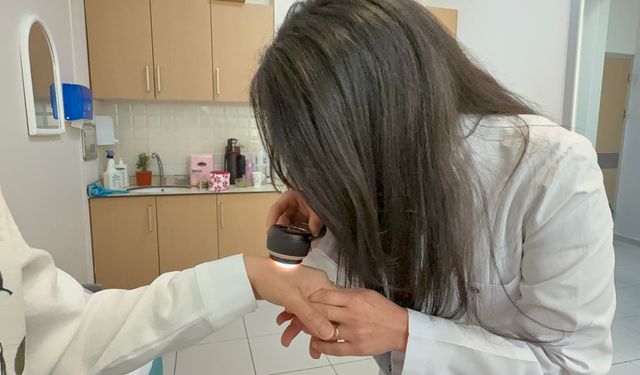Güneşe dikkat: Alerji vakalarında artış başladı