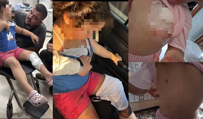 Pitbull saldırısının yeni görüntüleri ortaya çıktı: 5 yaşındaki çocuğun hali yürek burktu