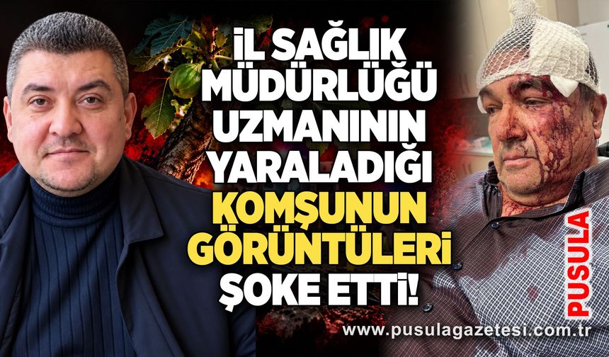 İl Sağlık Müdürlüğü uzmanının yaraladığı komşunun görüntüleri şoke etti!