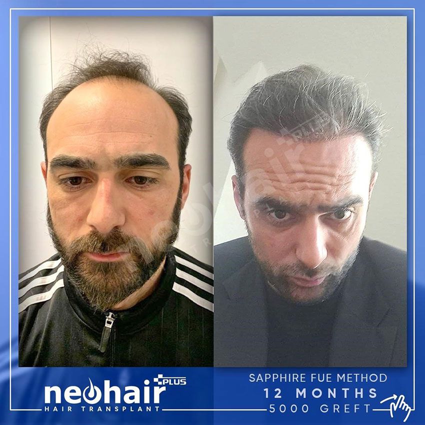 Neohair