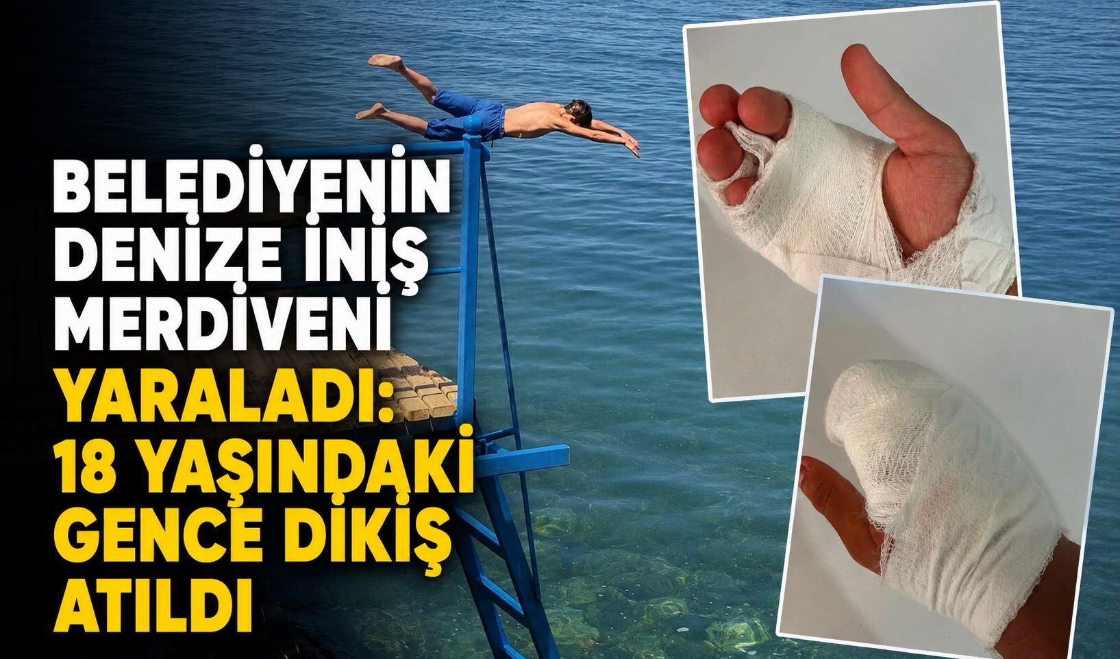 Belediyenin denize iniş merdiveni yaraladı: 18 yaşındaki gence dikiş atıldı
