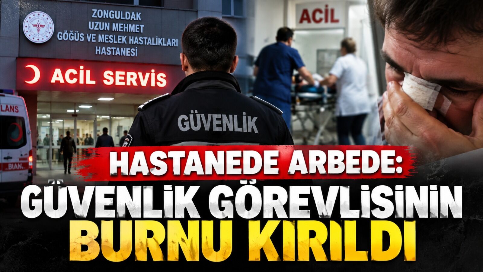 Hastanede arbede: Güvenlik görevlisinin burnu kırıldı