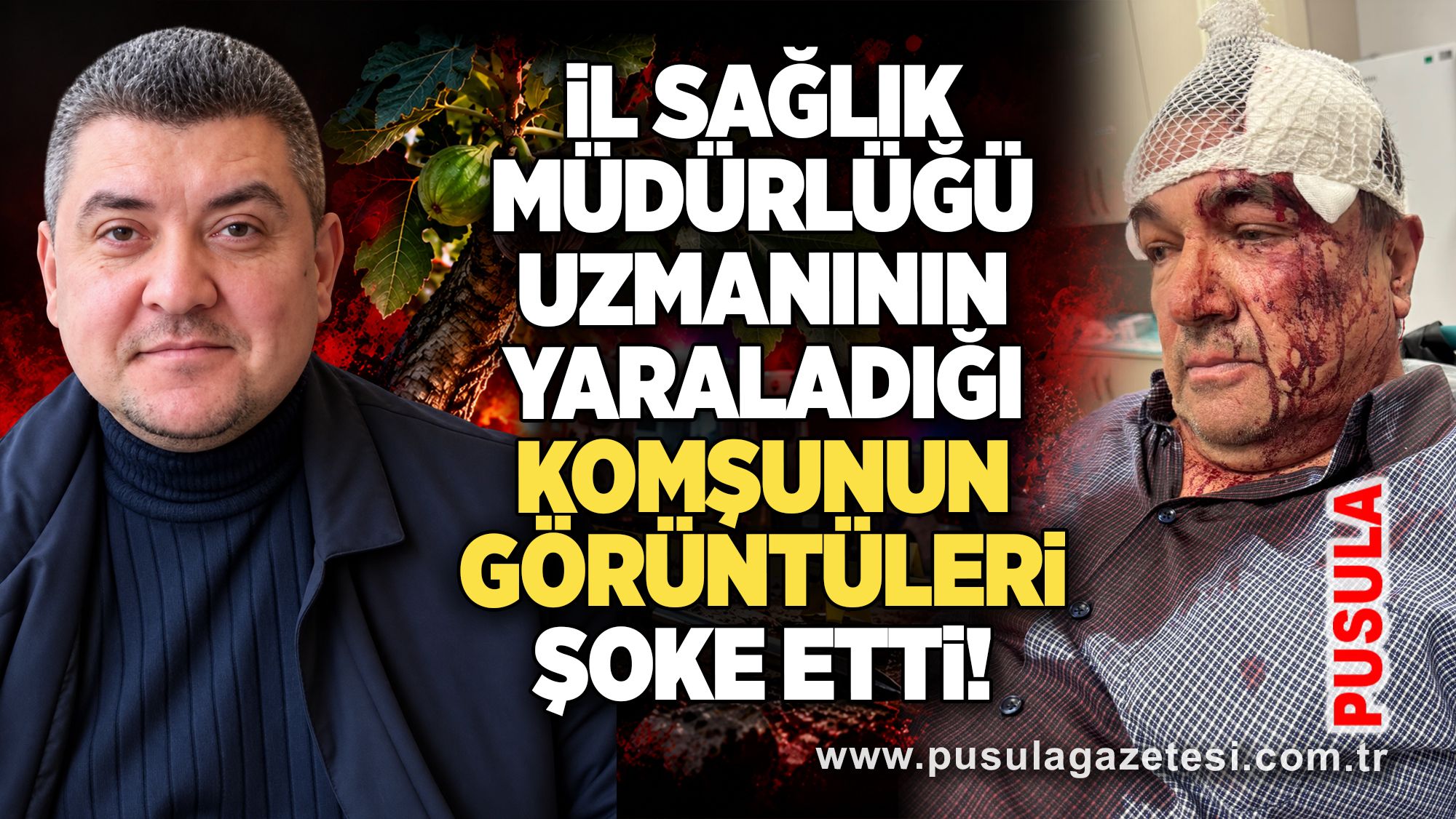 İl Sağlık Müdürlüğü uzmanının yaraladığı komşunun görüntüleri şoke etti!